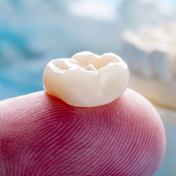 Close up of a dental crown on a finger