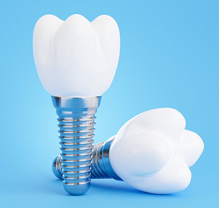 Two dental implants on a blue background