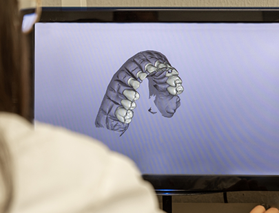 Virtual model of teeth on computer monitor