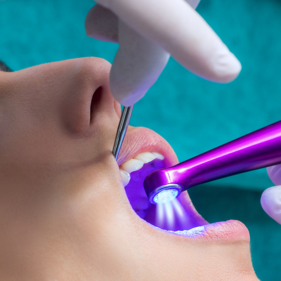 Holding patient's mouth open to apply dental sealant